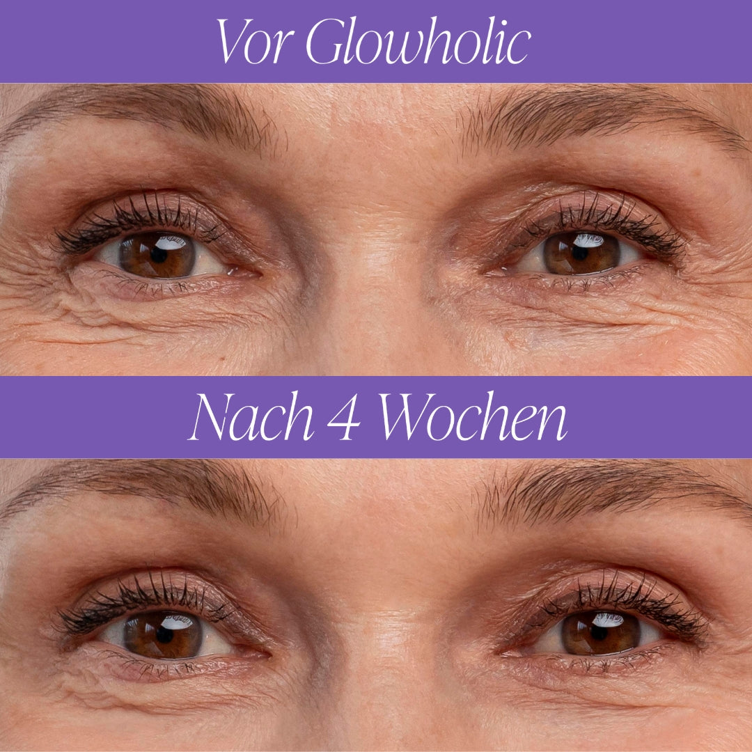 Glowholic Anti-Falten Micro-Needling Infusion Patches