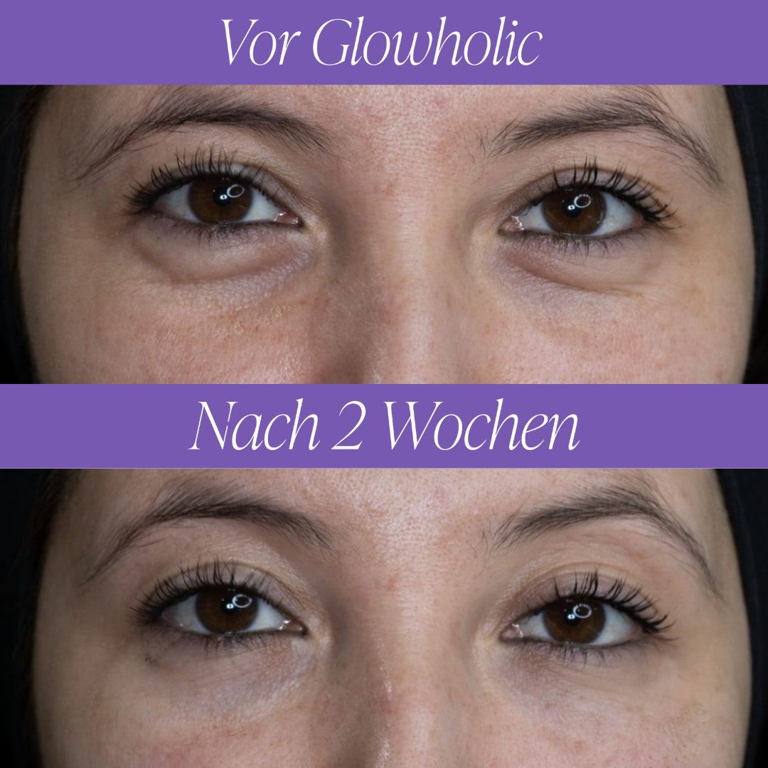 Glowholic Micro-Needling Eye Patches
