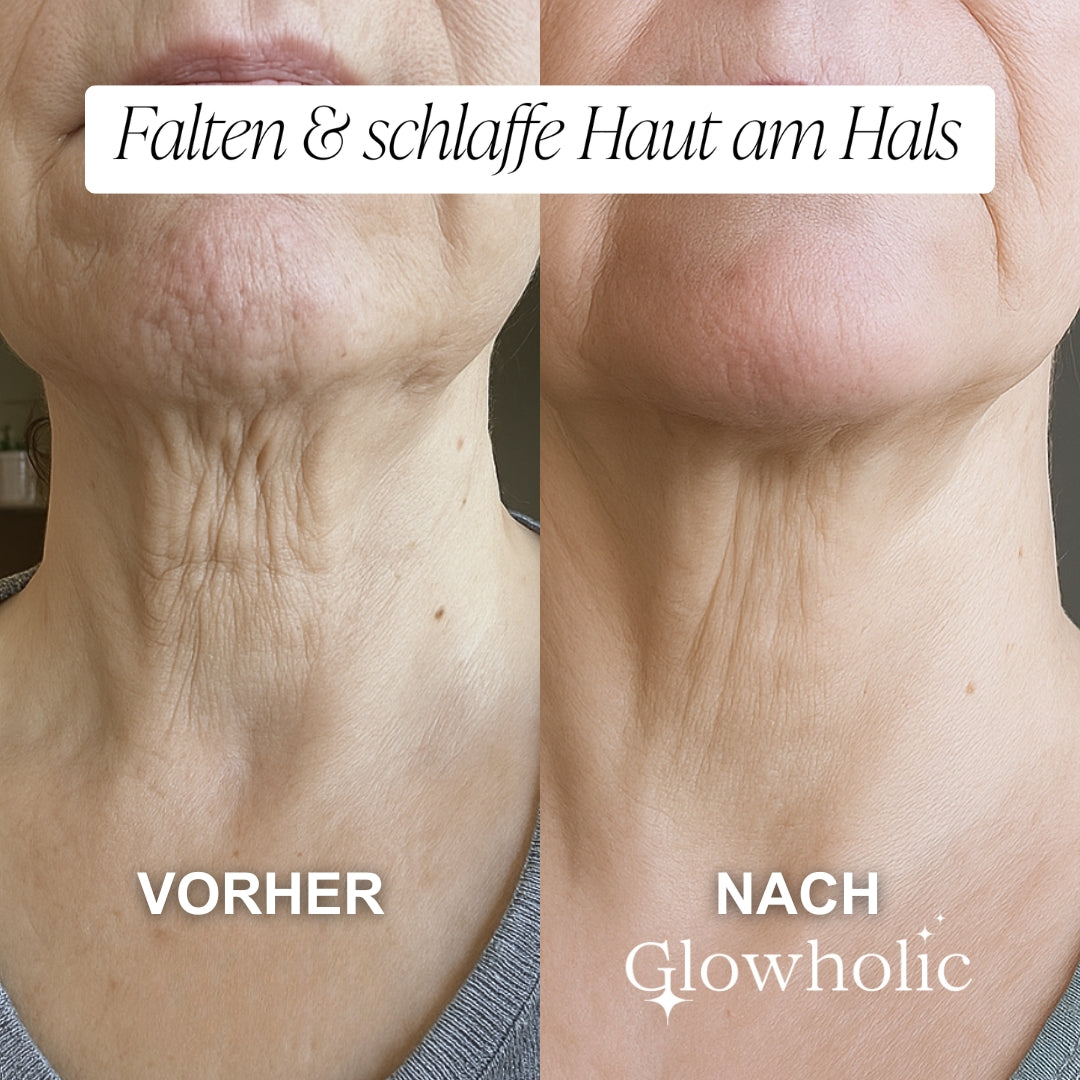 Glowholic Micro-Needling Infusion Anti-Aging Nachfüll-Seren