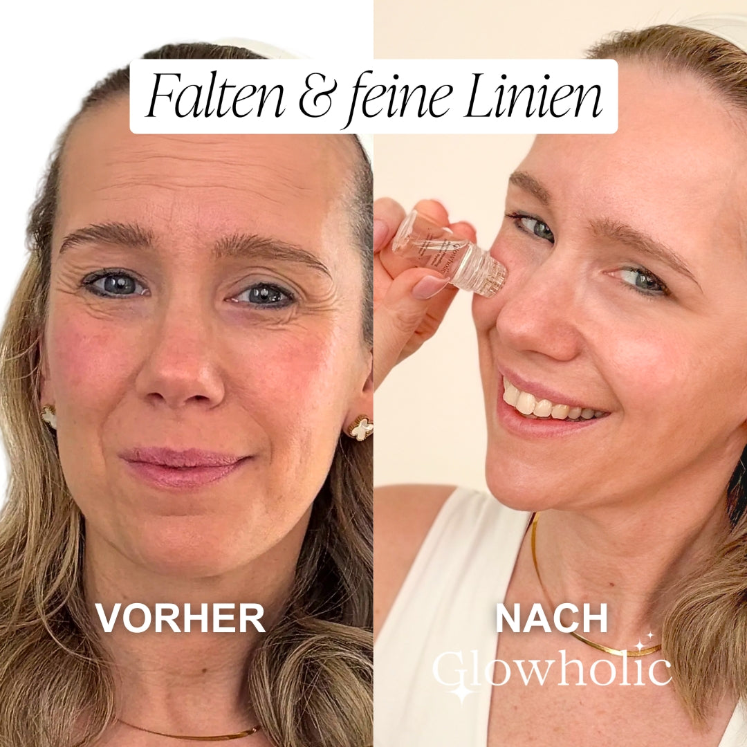 Glowholic Micro-Needling Infusion Anti-Aging Nachfüll-Seren
