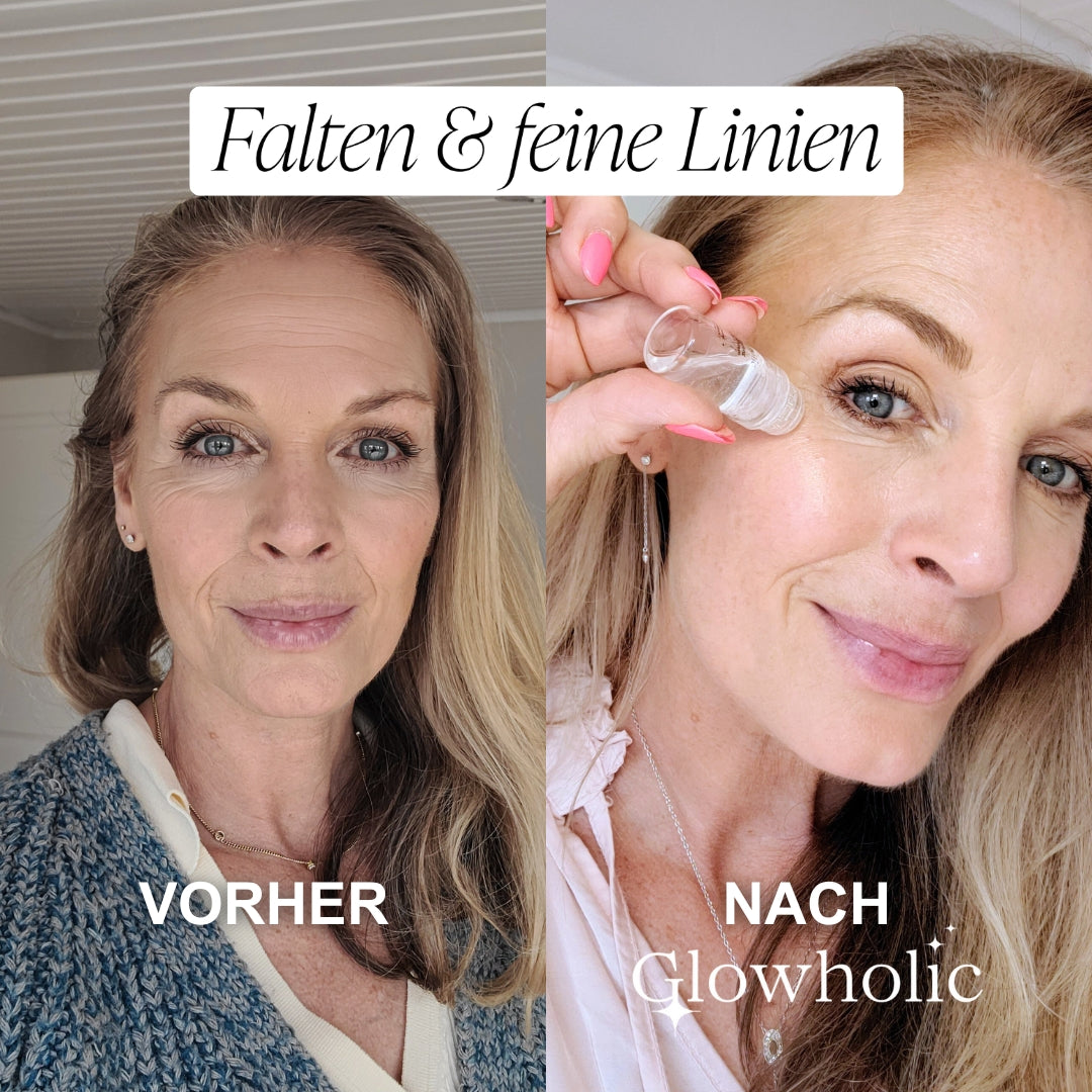 Glowholic Micro-Needling Infusion Anti-Aging Nachfüll-Seren
