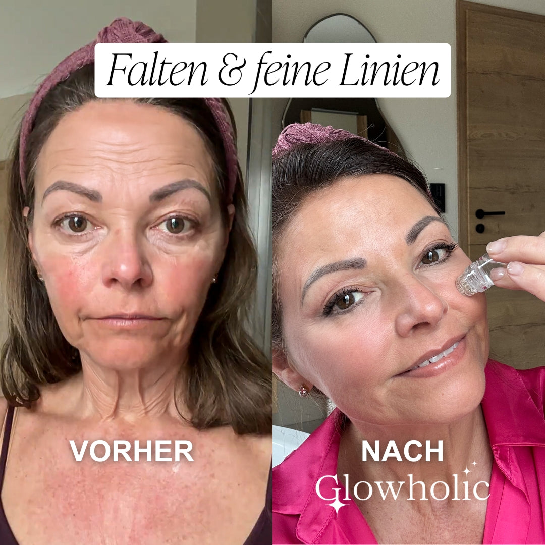 Glowholic Micro-Needling Infusion Anti-Aging Nachfüll-Seren